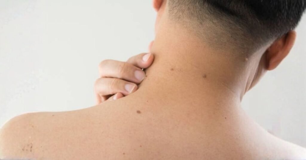 what causes skin tags +-
