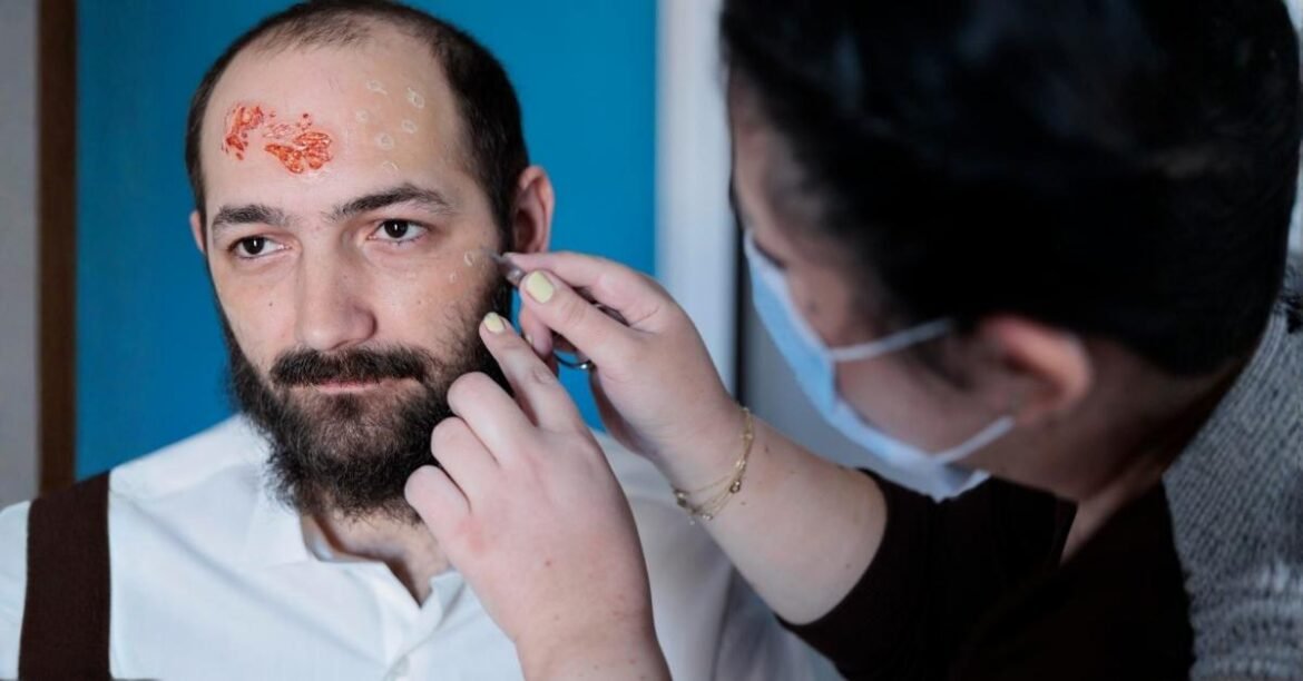 what causes skin tags