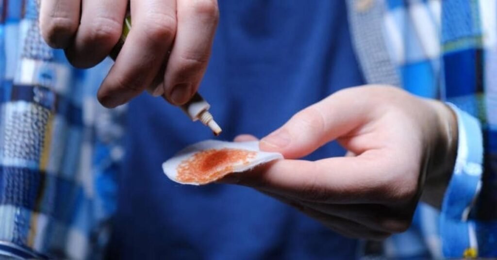 how to get super glue off skin