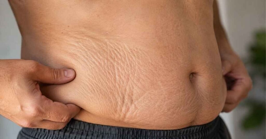 Crepe Skin